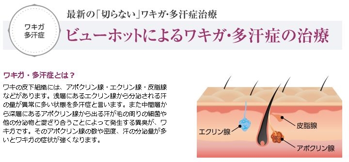 最新ビューホット治療